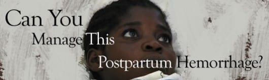 can-you-manage-this-postpartum-hemorrhage-banner