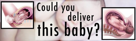 Could You Deliver This Baby?